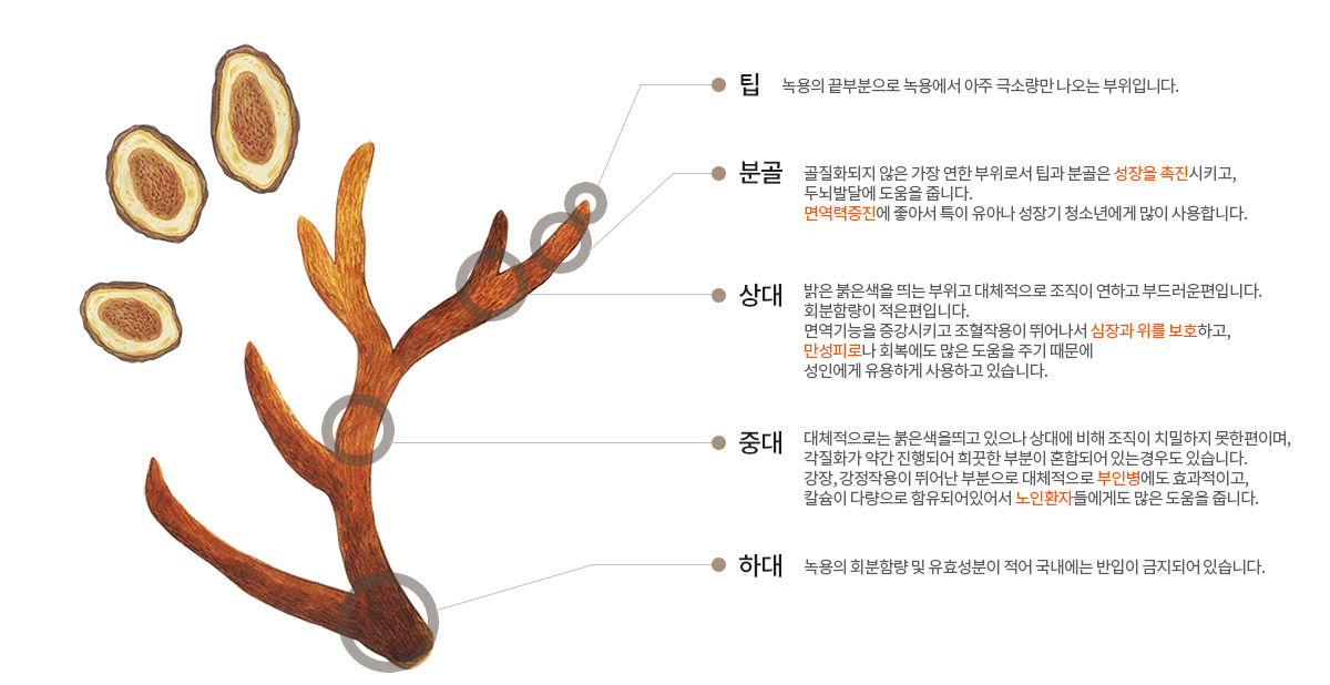 이명 환자의 체질과 전신 상태를 고려한 한약 상담 이미지